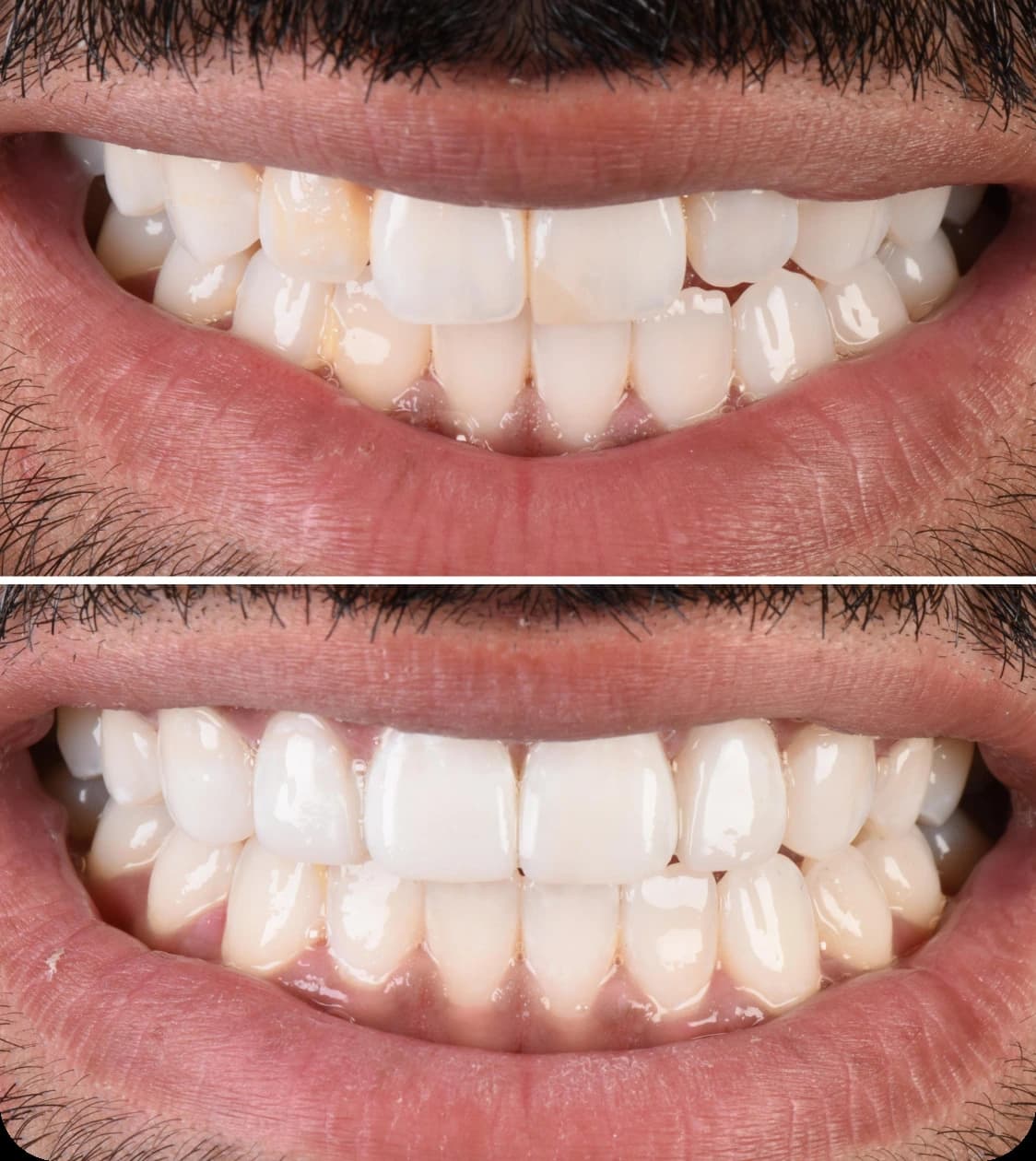 Result Image